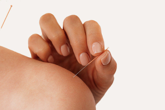 Terapeuta wkłada igłę do akupunktury do ramienia