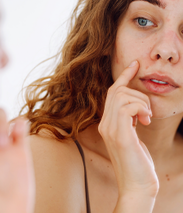 WITH PROBLEMATIC SKIN